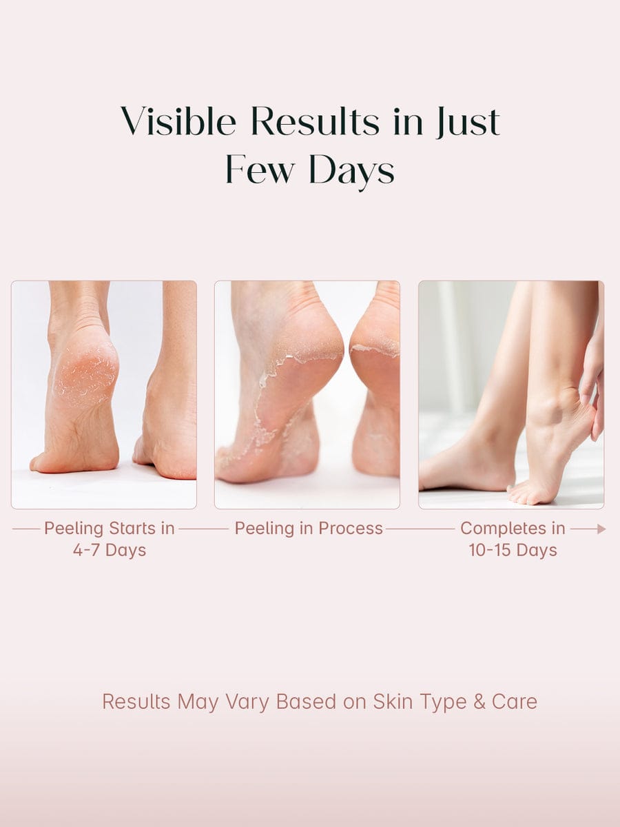 Exfoliating Foot Peel Mask (One pair) Seoul Skin