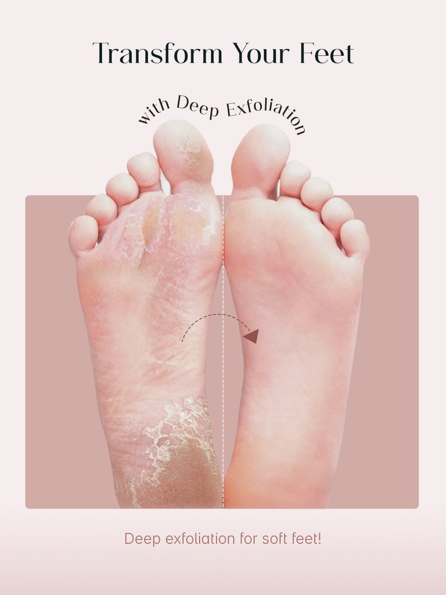 Exfoliating Foot Peel Mask (One pair) Seoul Skin